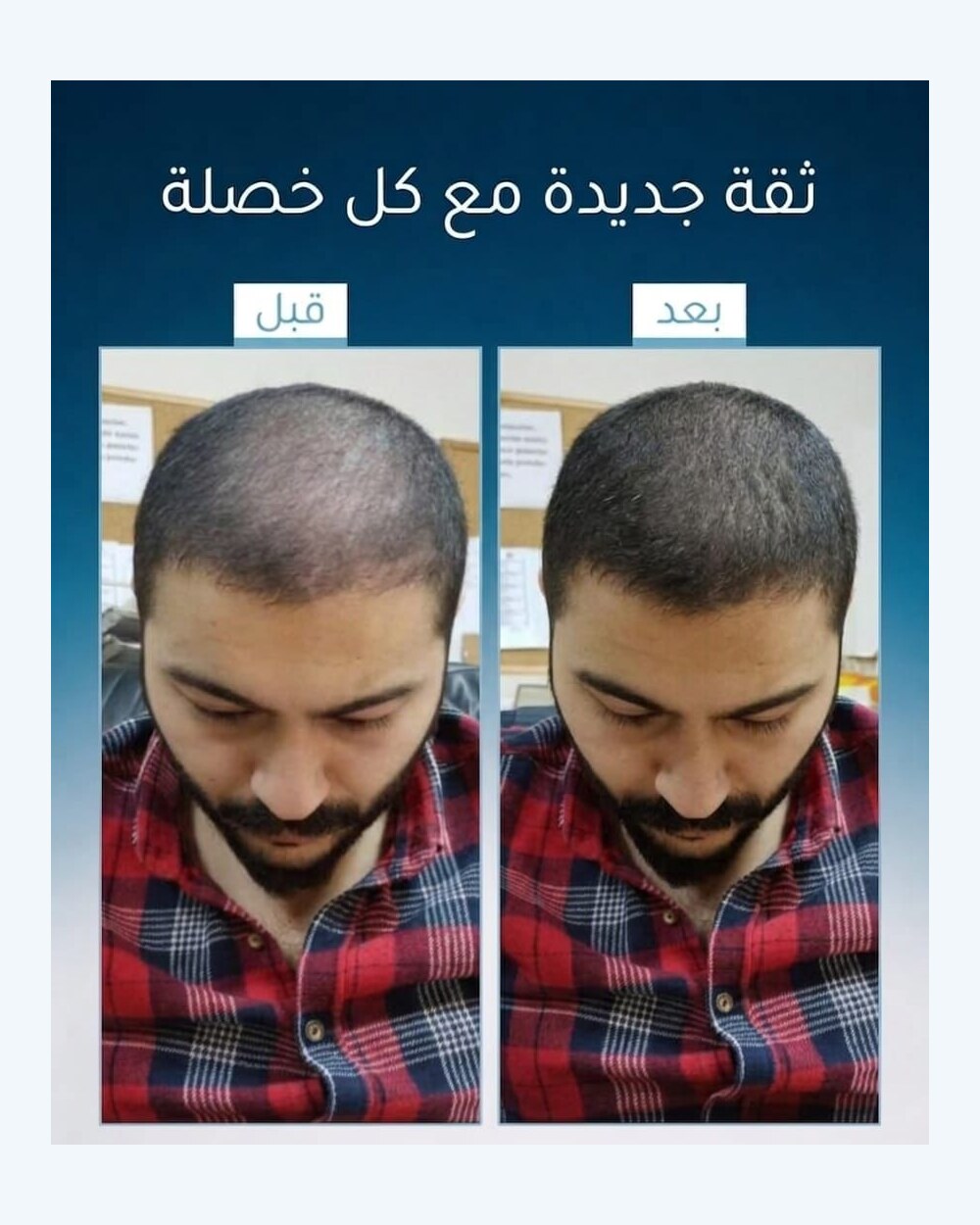 نتائج عميل FI BLUE 3